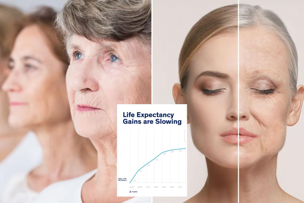 Life expectancy gains have waned despite medical advances